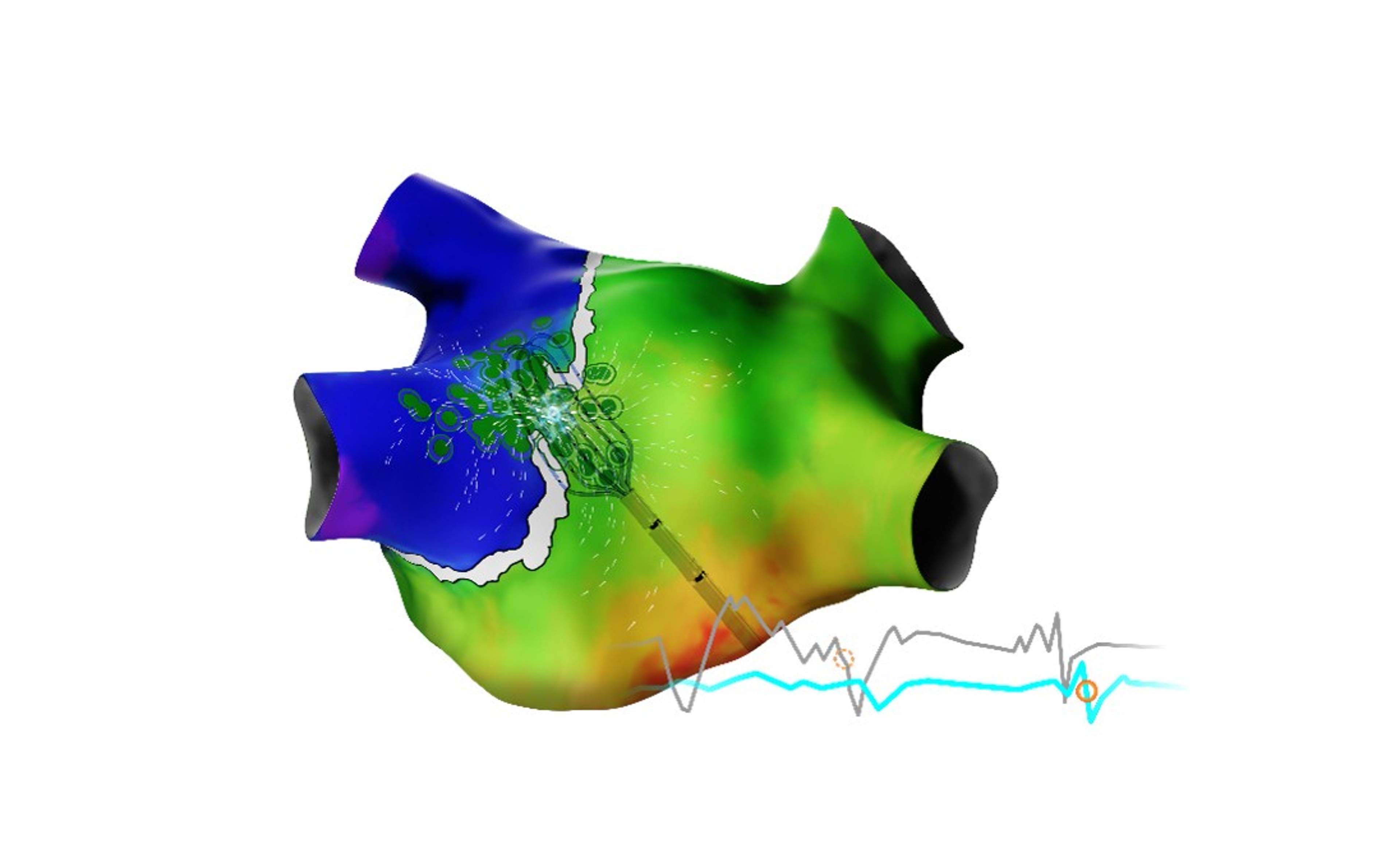 CARTO ELEVATE™ Module