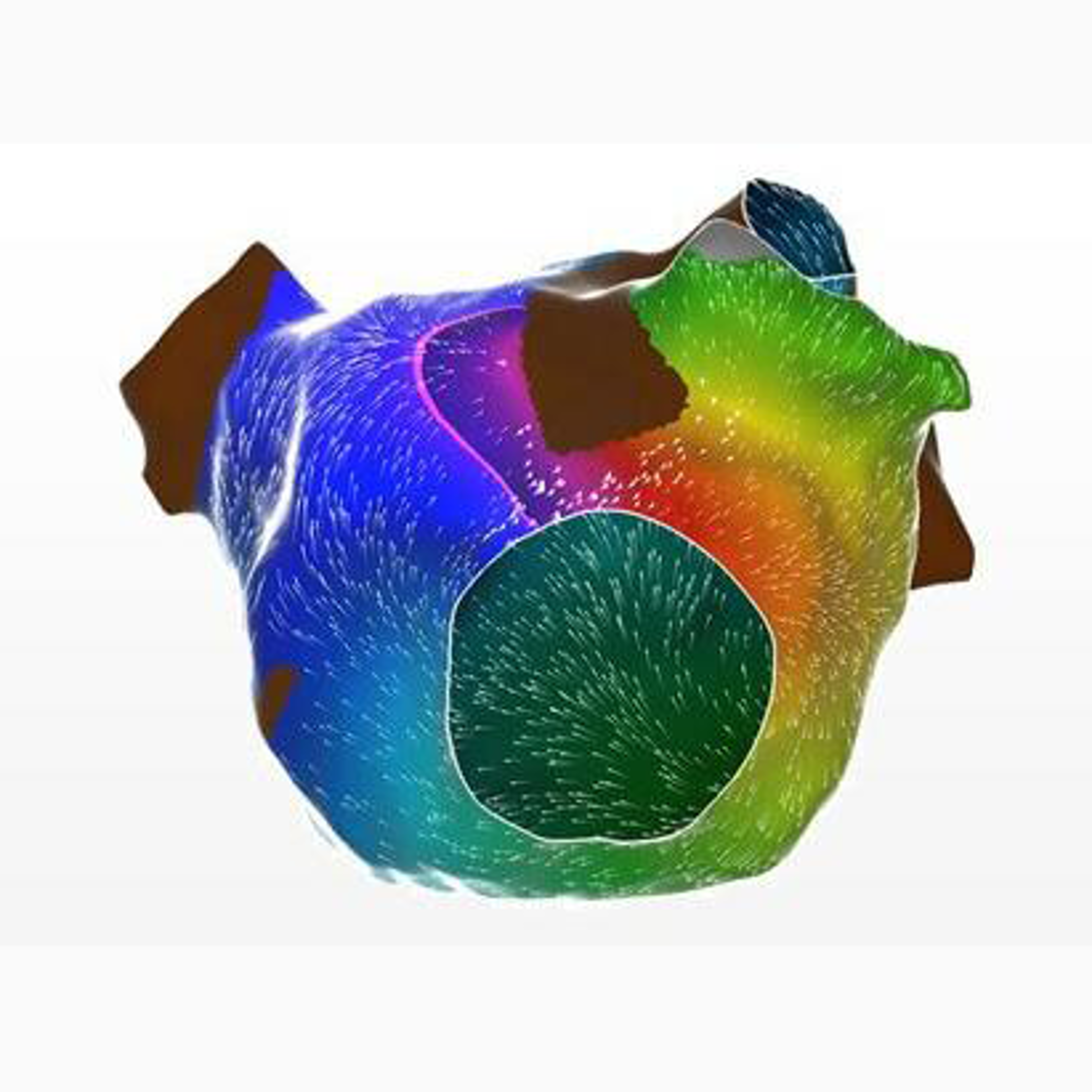 A 3D atrial anatomy model displays multicolor activation mapping, with blue, green, yellow, and red regions indicating differences in electrical timing and conduction.