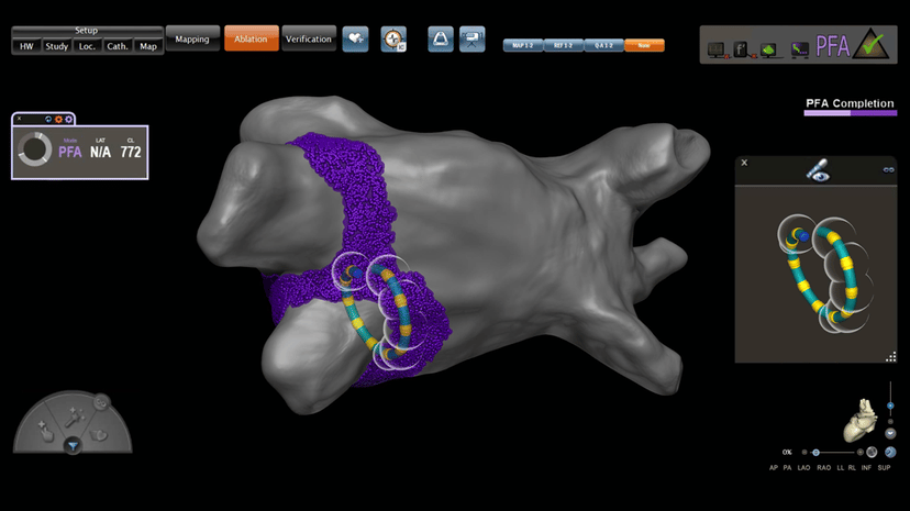 VARIPULSE™ Platform | J&J MedTech US