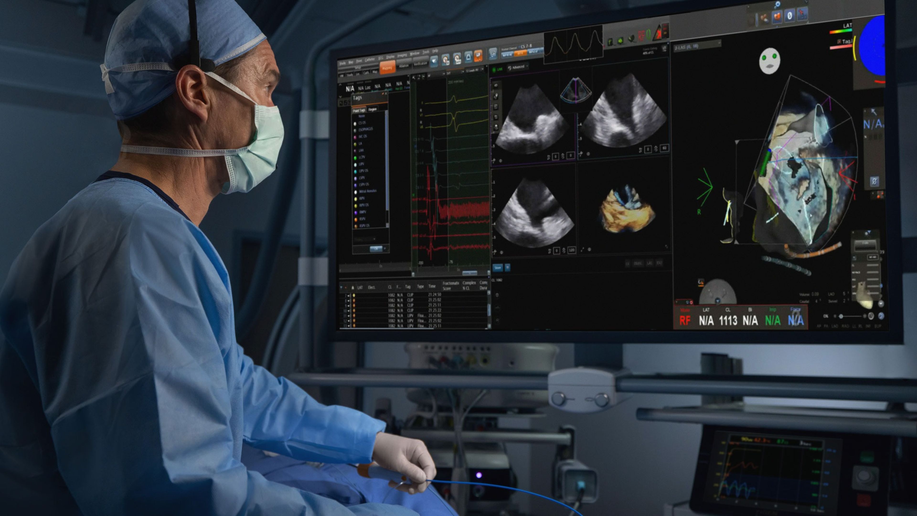 A clinician wearing a surgical mask and headset closely examines a large display screen showing multiple intracardiac ultrasound images, real-time electrograms, waveform traces, and mapping tags.