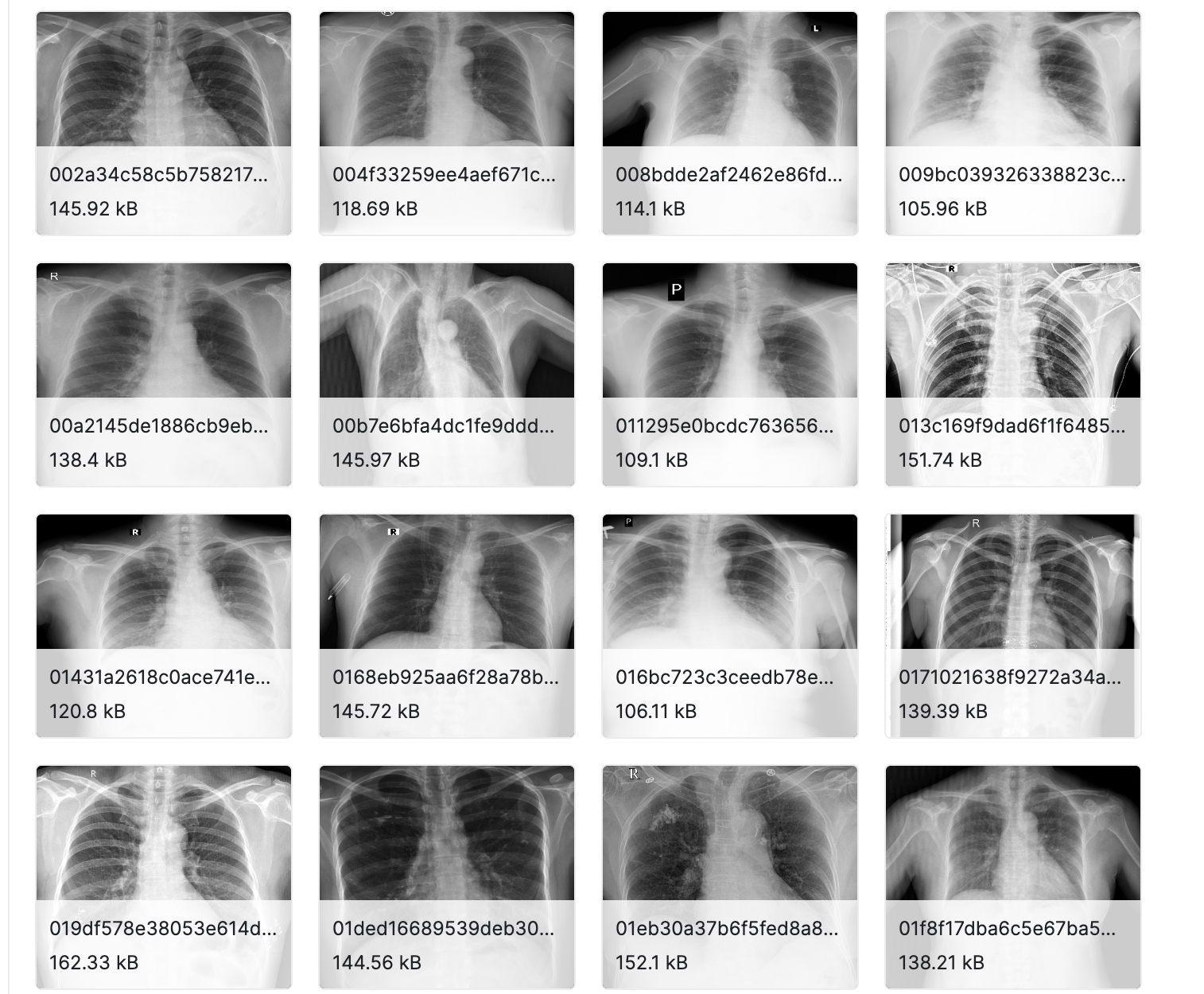 VinBigData 512 Image Data set for YOLOv5 tutorial