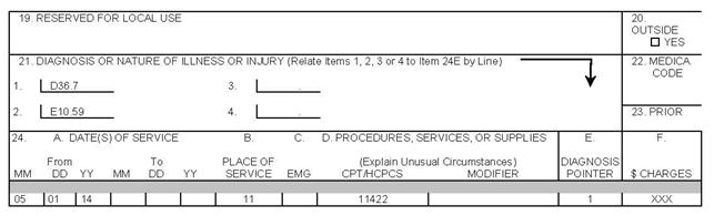 CMS 1500 claim form example of ICD-10-CM example 3