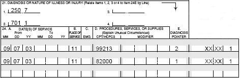 Medical claim form (CMS-1500) showing diagnosis codes 701.1 with procedures 99213 and 82000.