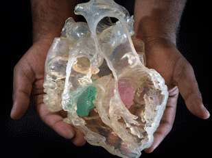 3D printout of a heart