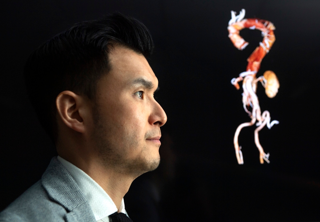 Man with vascular model in background.