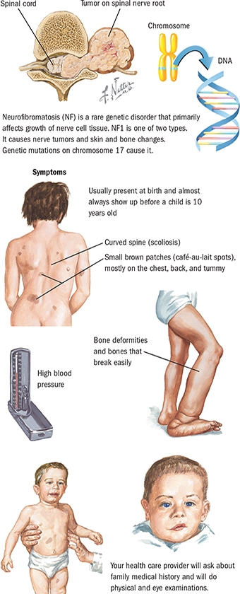 Infographic of symptoms
