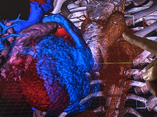 3D image of organ