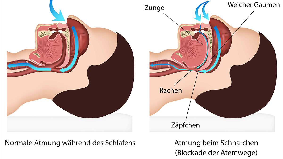 Ratgeber-Schlaf-Entspannung-Schnarchen-Infografik.jpg