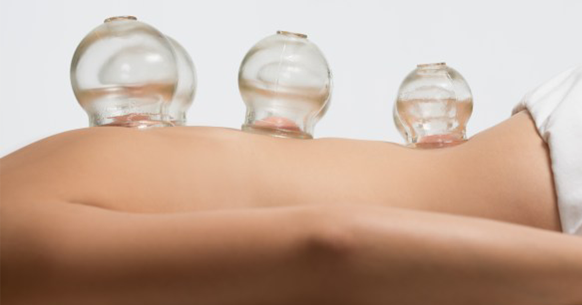 blog-naku-Massagegeräte im Test-13_Schröpfmassage.png