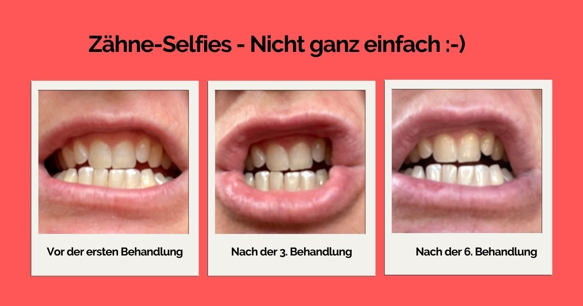 Zaehne_smilepen.jpg