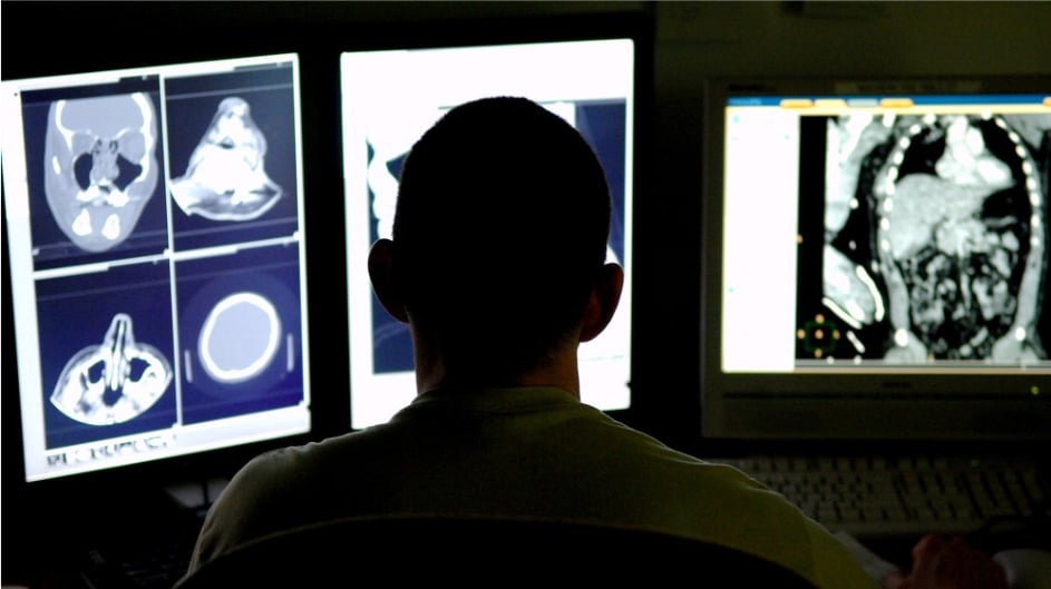 Medical imaging for COVID-19
