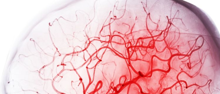 A photograph of blood vessels