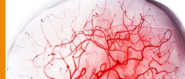 A photograph of blood vessels