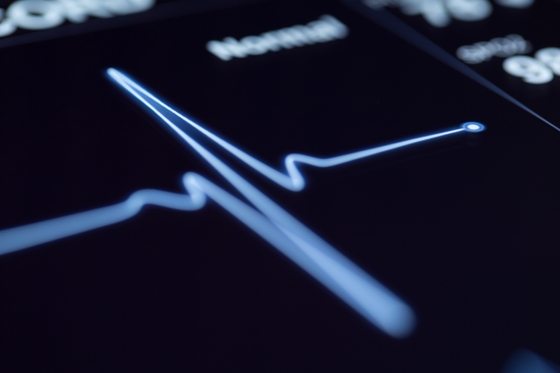 A close-up of a heartbeat monitor displaying vital signs.