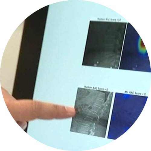 Finger pointing at a medical scan displayed on a screen.