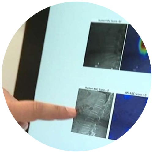 Finger pointing at a medical scan displayed on a screen.