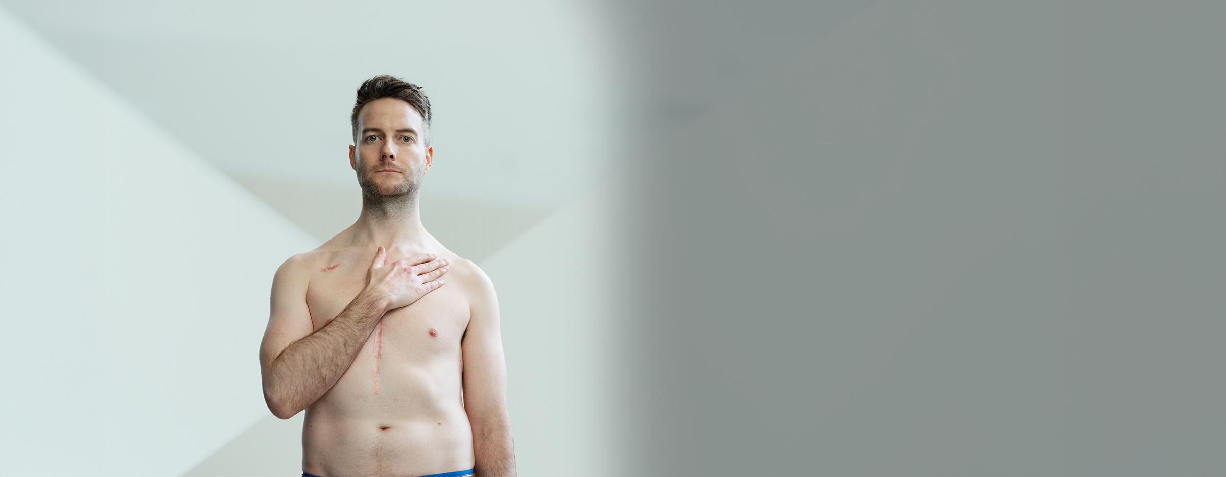 Geoff Lester shirtless with his hand on heart, visible scar from heart surgery