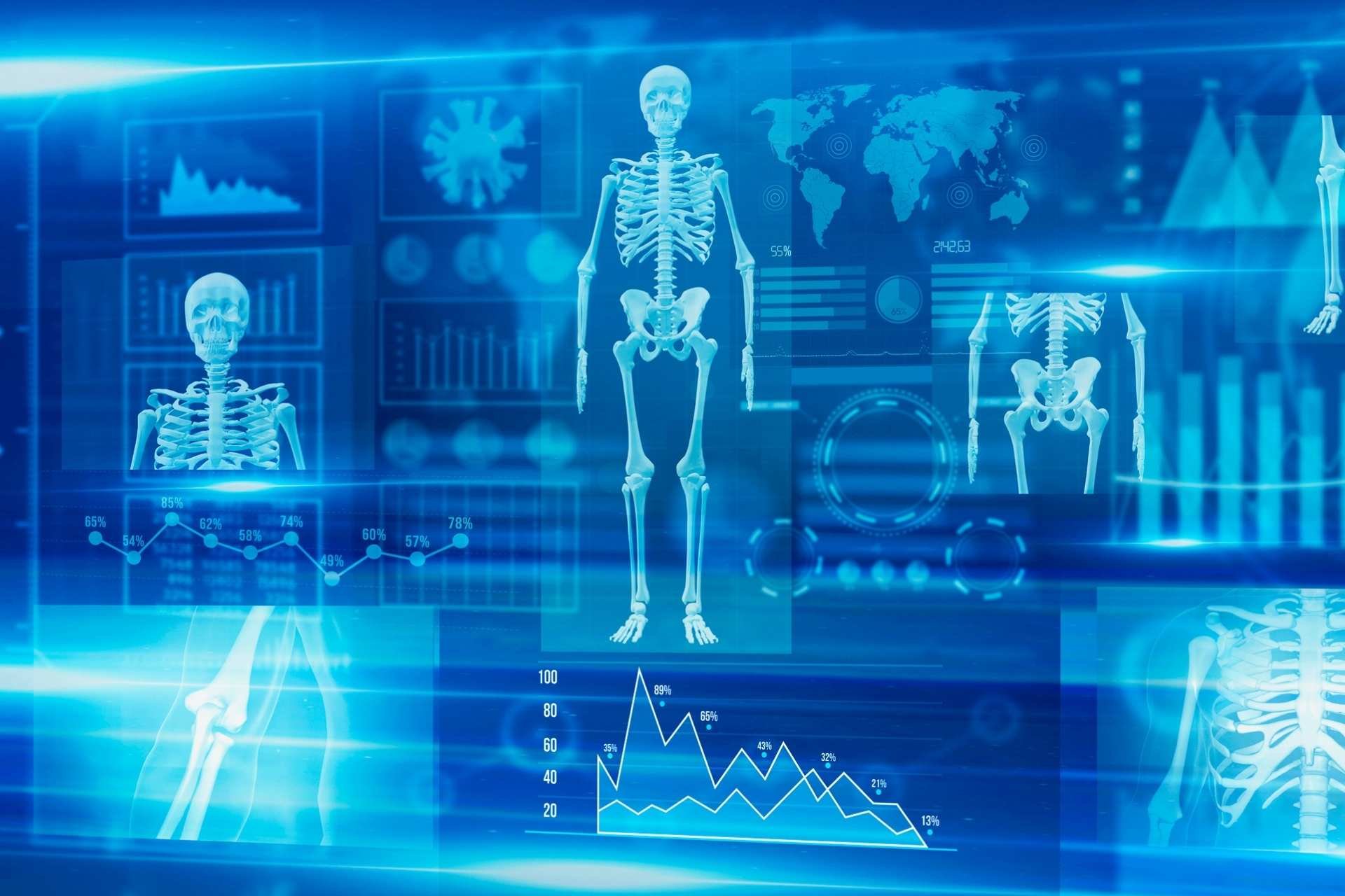 Graphic imagery of bone scan