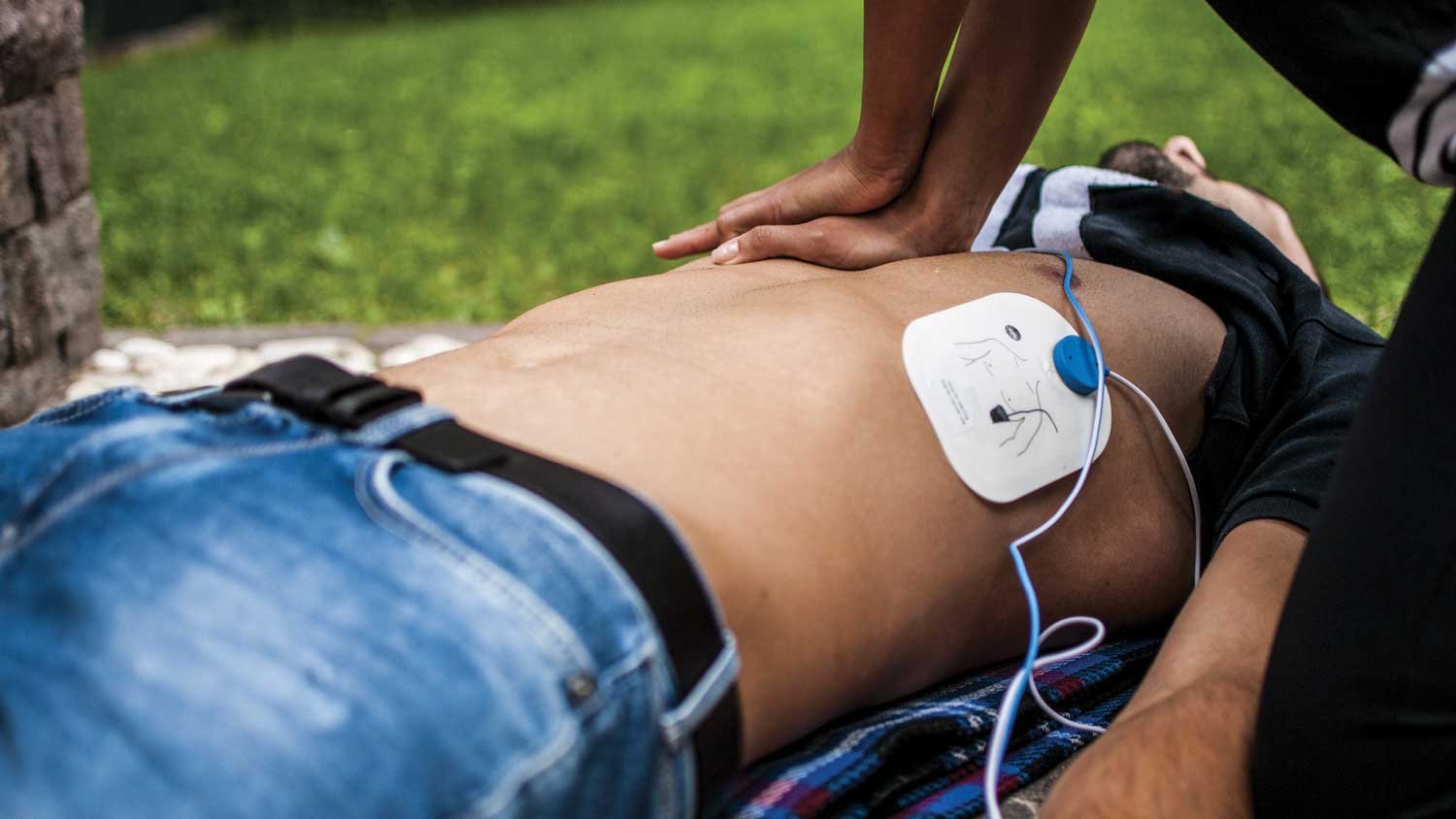 Male body with AED and resuscitation