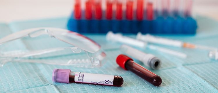 Test tubes containing blood