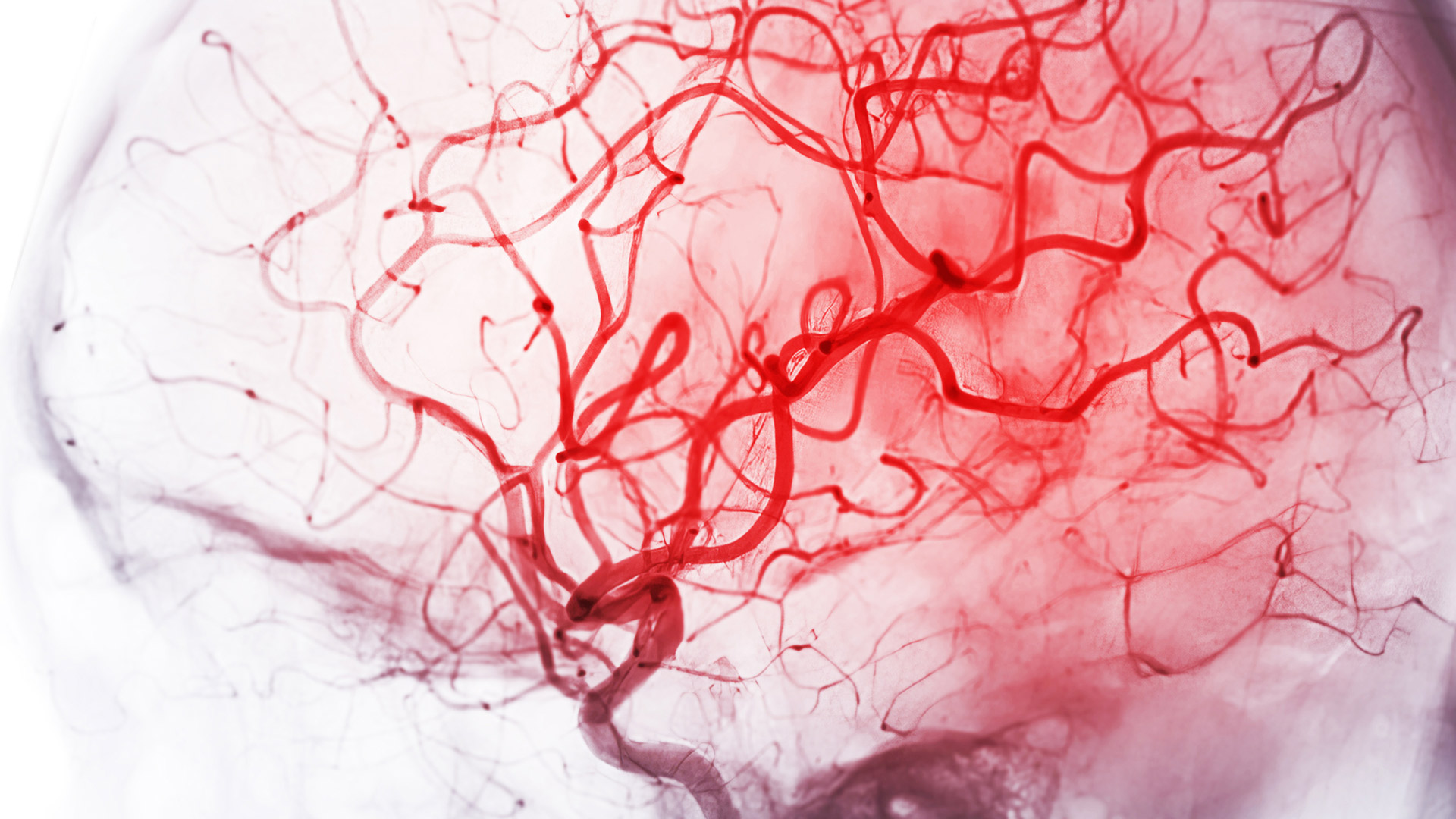 A new therapeutic ‘molecular glue’ that helps seal and repair one of the earliest changes in Alzheimer’s disease