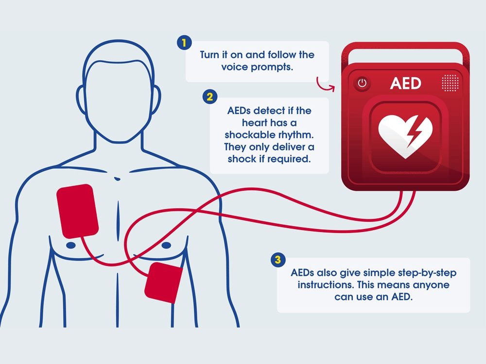 Infographic titled 'Using an AED' showing a simplified human figure with two red electrode pads—one on the chest and one on the side—connected by wires to an AED device. Three instructional steps are listed: 1) Turn on the AED and follow voice prompts, 2) AEDs detect shockable heart rhythms and deliver a shock only if needed, 3) AEDs provide simple, step-by-step instructions for anyone to use.