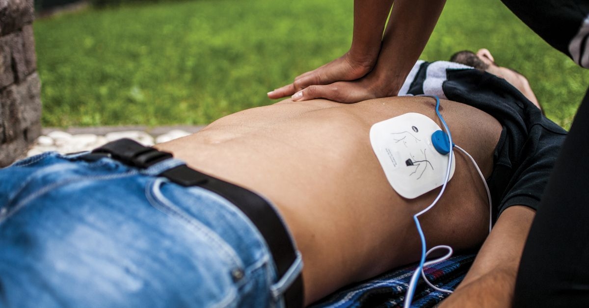 A person receiving CPR compressions with AED pads on their chest. 