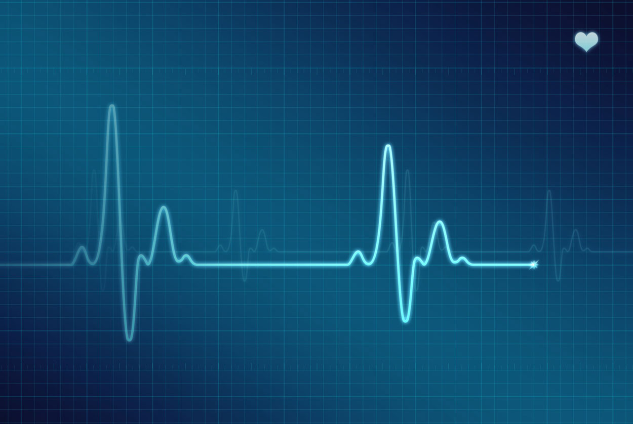 Understanding AFib: How to measure your own heart rate and rhythm