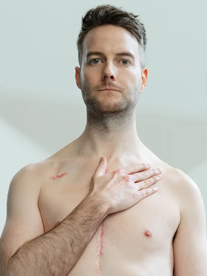 Dr Geoff Lester, standing shirtless holding his heart on his heart, heart surgery scar on chest