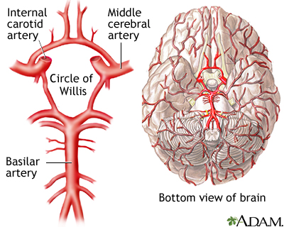 Circle of Willis image
