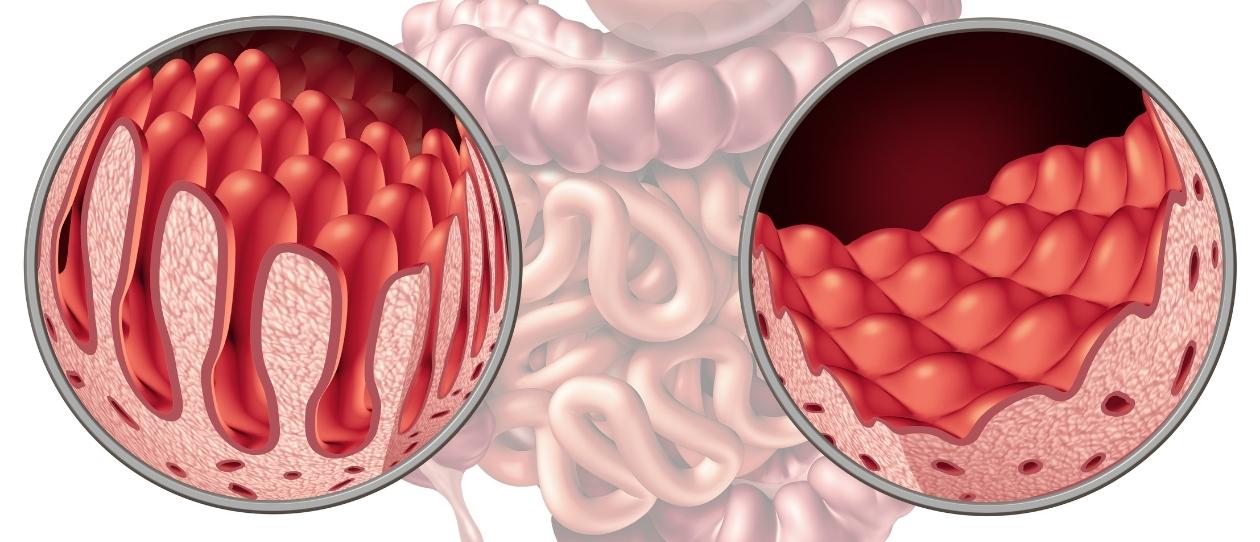 coeliac_awareness_week_1260x542.jpg