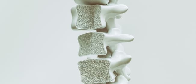 bi_osteoporosis_factsheet.jpg