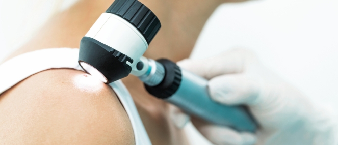 bi_non-melanoma-skin-cancers_factsheet.jpg