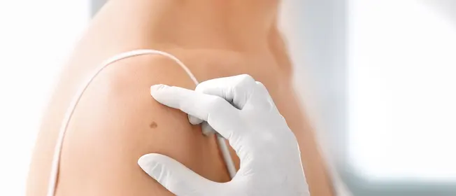 VitB3_SkinCancerPrevent_WebMain_1260x542.jpg