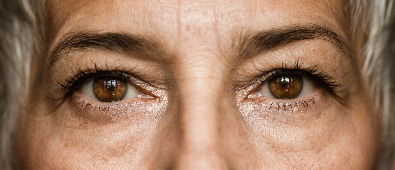 b3-glaucoma_1260x542.jpg