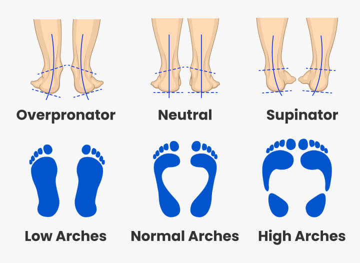 How to Choose Running Shoes Types & Mistakes to Avoid Academy