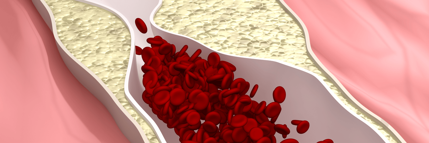 The low-down on cholesterol