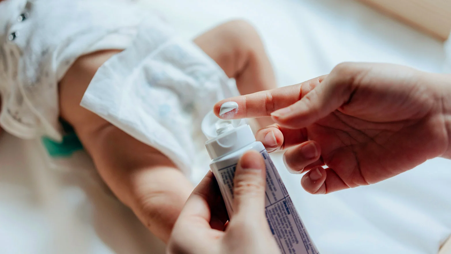 A stock photo of someone applying diaper rash cream to their finger.