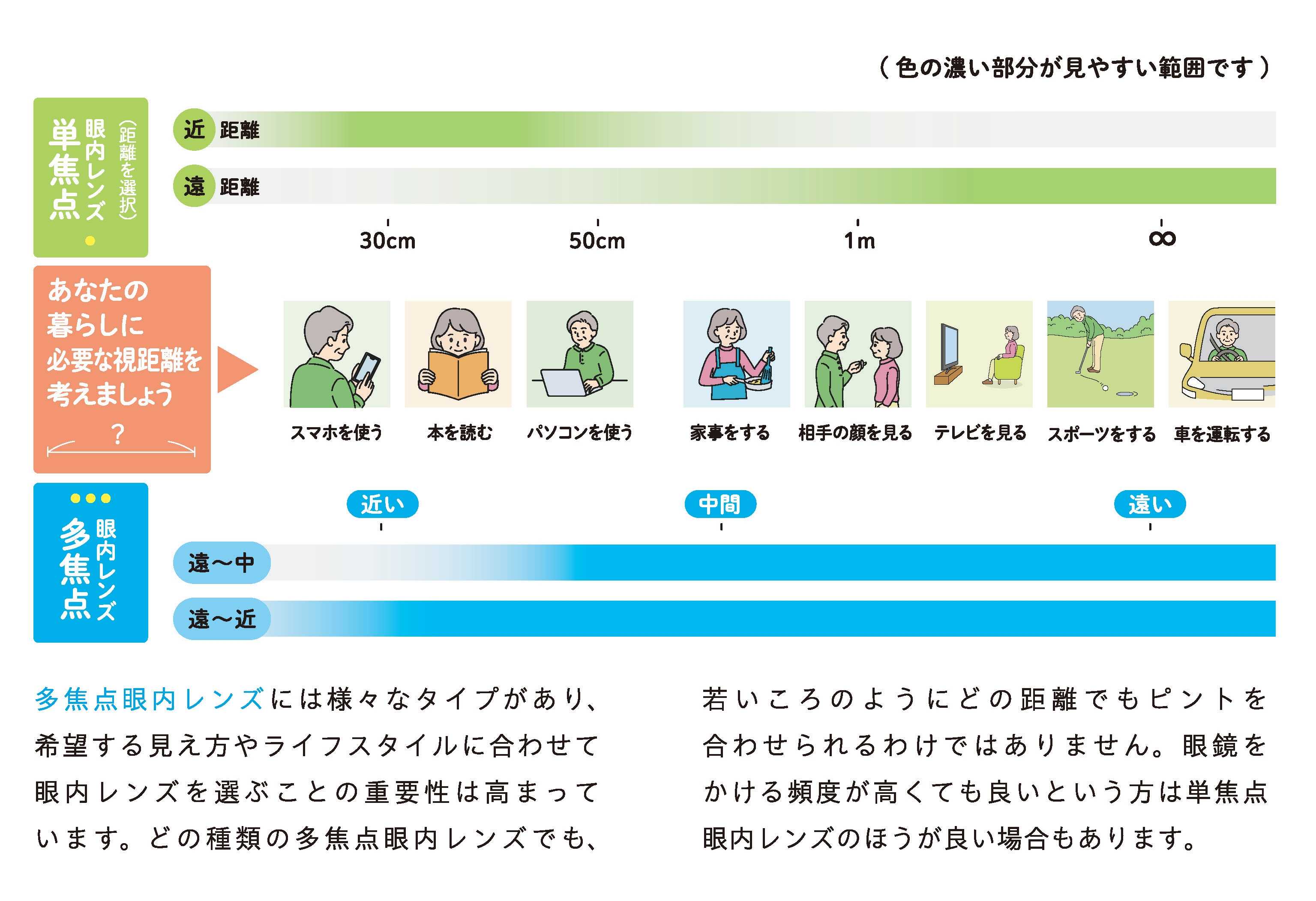 焦点眼内レンズの種類