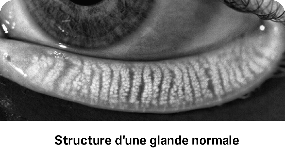 Structure d’une glande normale