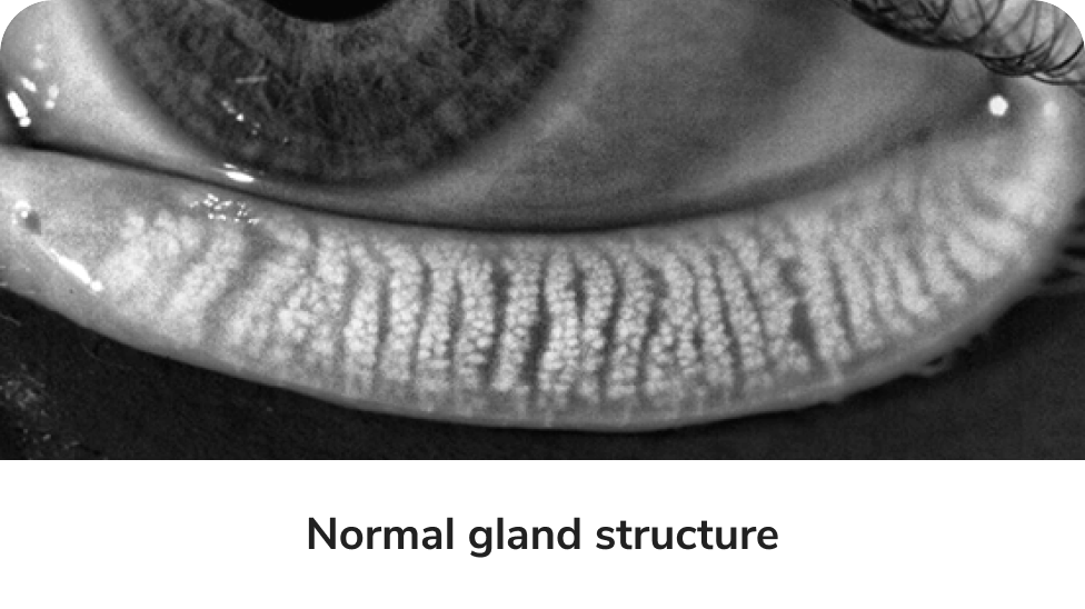 Normal gland image