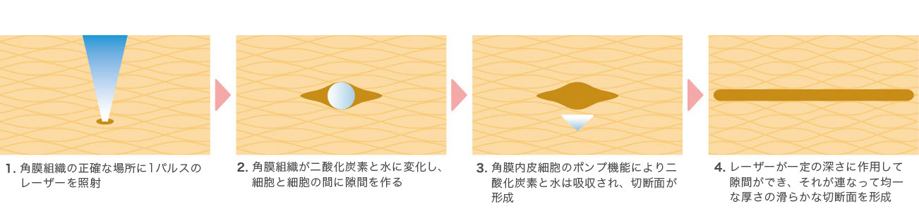 フェムトセカンドレーザーとは