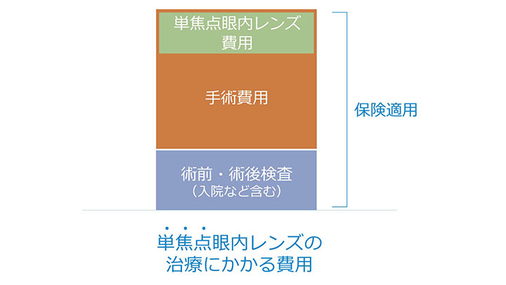 単焦点眼内レンズの治療にかかる費用　単焦点眼内レンズ費用・手術費用・術前術後検査　保険適用