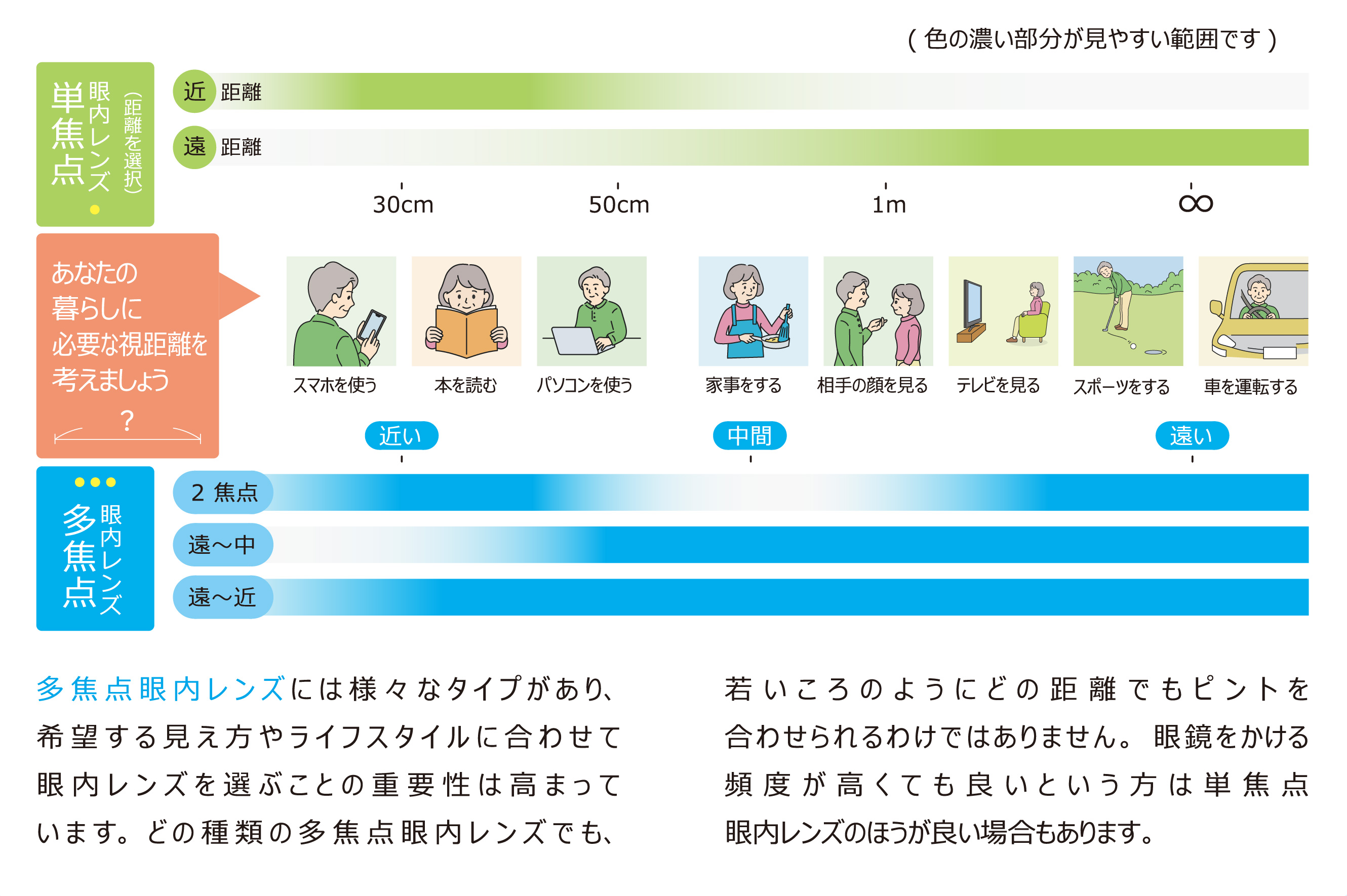 焦点眼内レンズの種類