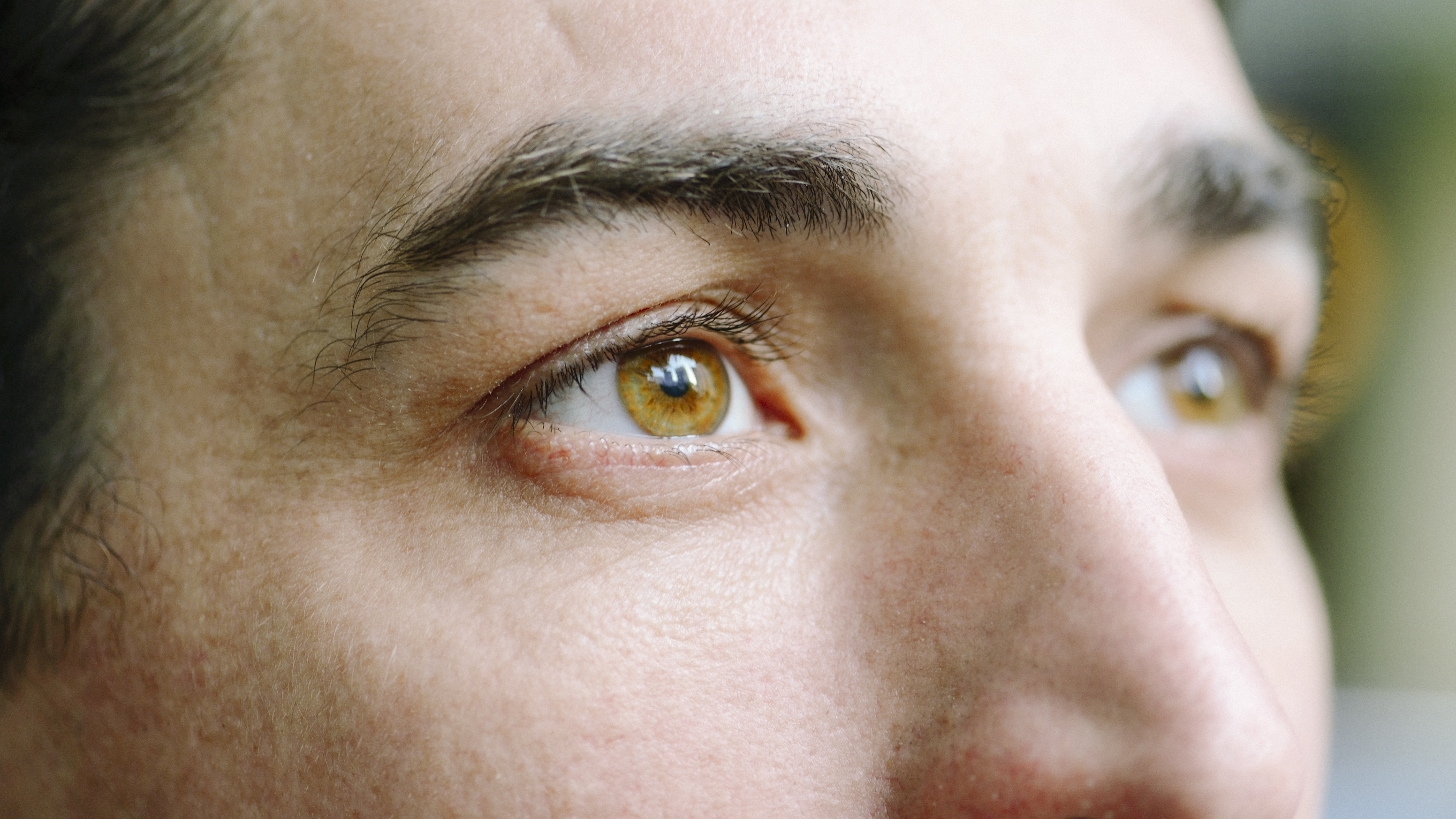 Lenticule Extraction