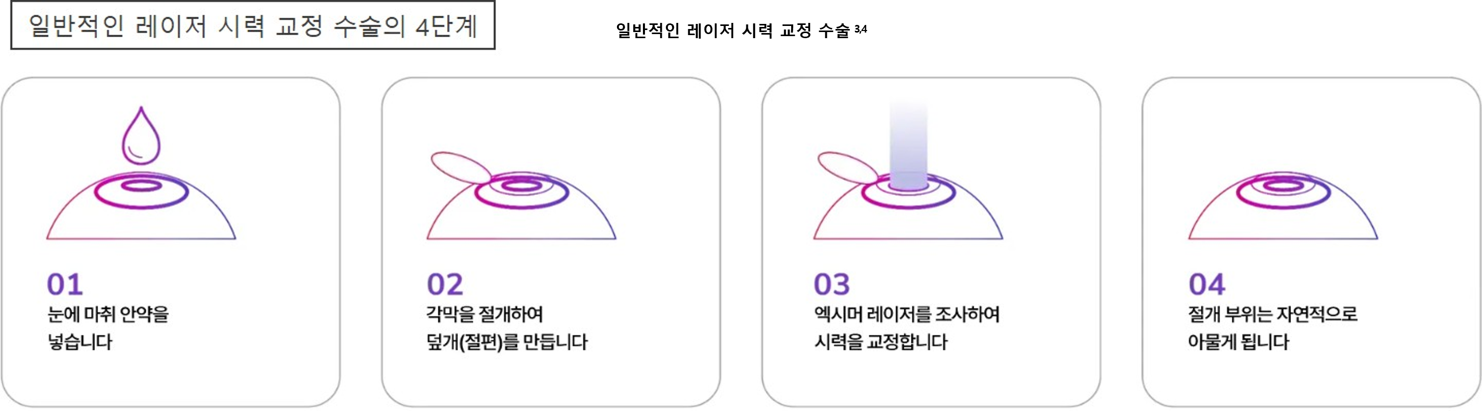 굴절이상 설명 사진