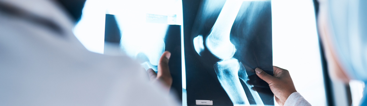 Embracing nutritional support for stronger joints!
