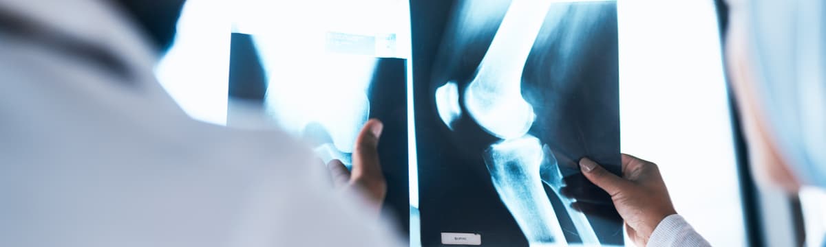 Embracing nutritional support for stronger joints!