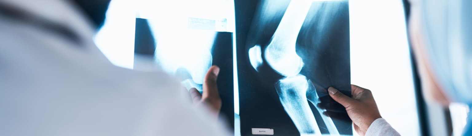 natural support for better bones header.png