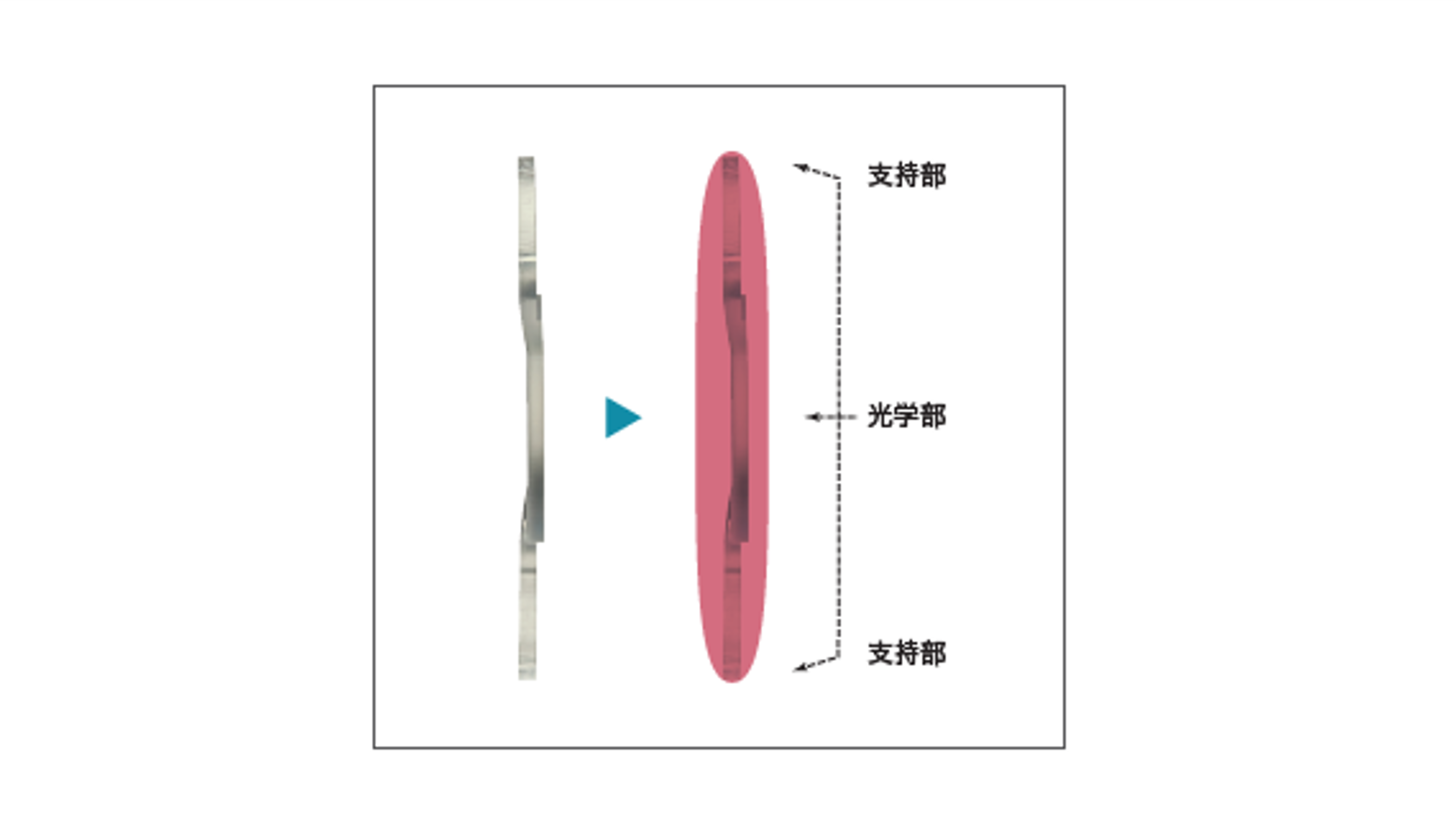 Tri-Fix3点固定方式により眼内で高い安定性